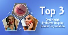 Top 3 Oral Health Problems Require Dental Consultation •	Dry Mouth •	Difficulty Chewing and Biting •	Pain in Mouth Jaw Pain, Dry Mouth