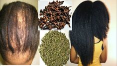 Ways To Grow Hair, Herbs For Hair Growth, Caring For Frizzy Hair, Natural Hair Growth Oil, Herbs For Hair, Natural Hair Growth Tips, Hair Growth Spray