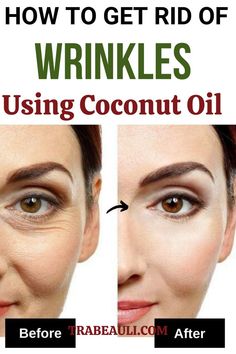 Learn how to naturally reduce wrinkles with coconut oil. This DIY remedy helps hydrate, nourish, and repair skin, promoting a smoother and more youthful appearance by diminishing fine lines and improving skin elasticity. Home Remedies For Wrinkles, Diy Wrinkles