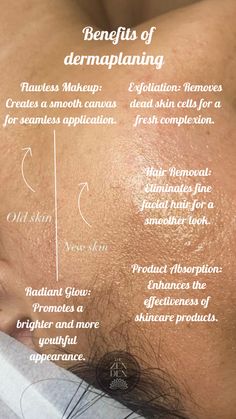 DERMAPLANING THE SKIN Solo Esthetician, Facials Quotes, Relaxing Facial, Facial Benefits, Esthetician Inspiration, Esthetician Quotes, Esthetician Marketing, Zen Den, Skin Care Business