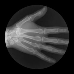 an x - ray image of the hand and wrist