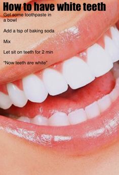 White Teeth Tips, Baking Soda Teeth Whitening, Get Whiter Teeth, Beauty Routine Tips, Trening Fitness