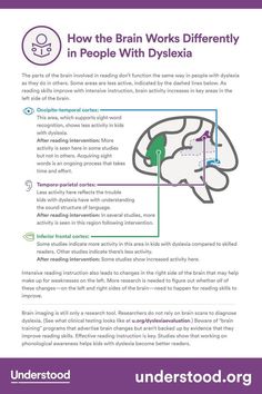 Dyslexic Brain, Intensive Reading, Word Recognition