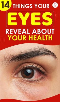 Forget the saying “Eyes are the windows to your soul.” They are actually indicators of your health! Long considered as one of the most attractive Eye Exercises, Physical Wellness, Alternative Health, Eye Health, Skin Health, Swag Nails, 10 Days, To Tell, Improve Yourself