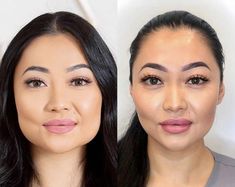 Botox Cheeks Before After, Masseter Botox Injection Before And After, Masseter Botox Injection, Botox Masseter Before And After, Jaw Botox Before After, Botox Masseter, Masseter Botox Before And After, Jaw Reduction Surgery