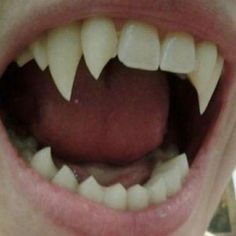 an open mouth with white teeth and no toothpaste on it's upper part