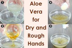 How to Soften Rough and Cracked Hands: 8 Home Remedies Extreme Dry Hands Remedies, Dry Hand Skin, Hand Soak, Chapped Hands, Healthy Life Hacks