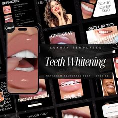 50 Teeth Whitening Instagram Templates | Tooth Gem Instagram Templates | Teeth Whitening Posts | Teeth Whitening Social Media Post Template What you get: 🦷50 Templates 🦷1 PDF with  Canva Link to open the Template (files size: 1080px x 1080px ) 🦷1 PDF with very detailed instructions for how to use canva ( you need an account that is free)  How it Works: 🔥You purchase the template. 🔥 Once Etsy confirms your payment, you can instantly download your PDF. 🔥 You read through the PDF instructions Teeth Whitening Professional, V34 Colour Corrector, Colour Corrector, Black Teeth, Small Business Instagram, Whitening Teeth, Dental Marketing, Perfect Teeth, Social Media Post Template