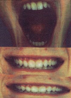 two pictures of teeth with missing toothpaste on them, one showing the upper and lower teeth