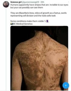 the back of a woman's body with brown spots on it and text that reads science