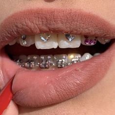 Brace Face, Diy Teething, Gel Primer, Grills Teeth, Tooth Gems