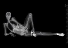 an x - ray image of a skeleton laying on the ground with her legs crossed