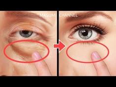 9mins Eye Bags Removal Exercises! Lift Up Dark Circles Under Eyes, Eye Wrinkles! Anti-Aging - YouTube Eye Workout, Remove Eye Wrinkles, Facial Routine Skincare, Massage Routine, Facial Routine, Eye Wrinkles