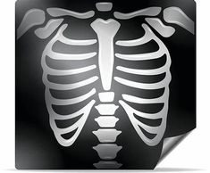 a skeleton with the ribs cut out to show it's ribcage and chest