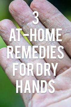 Dry Cracked Hands Remedy, Cracked Hands Remedy, Hand Remedies, Dry Hands Remedy, Extremely Dry Hands, Itchy Hands, Homemade Deodorant Recipe, Dry Hand Skin