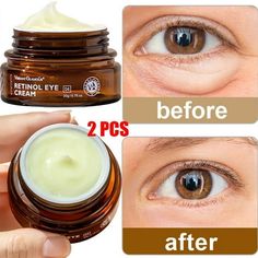 Features: 1. Our product is a new generation of retinol eye cream which contains a variety of nourishing essences, can effectively repair the eye skin, improve the fine lines around the eyes, aiming to make the eye skin bright and firm. 2. This eye cream is smooth, moisturizing, gentle and harmless, easy to absorb, suitable for all kinds of skin including sensitive skin. 3. Double retinol and arbutin have powerful anti-aging, anti-wrinkle and bright eye effects, can brighten dull skin, inhibit t Eye Cream For Puffy Eyes Bags, Best Eye Cream For Dark Circles, Puffy Bags, Eyes Bags, Best Under Eye Cream, Skin Care Eye Cream, Natural Eye Cream, Remove Eye Bags, Face Health