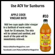 Putting Apple Cider Vinegar On Your Face Does THIS! Wow. Who Knew! Apple Cider Vinegar Sunburn, Apple Cider Vinegar Bath, Natural Remedies For Sunburn, Skin Natural Remedies, Acne Remedies, All I Ever Wanted