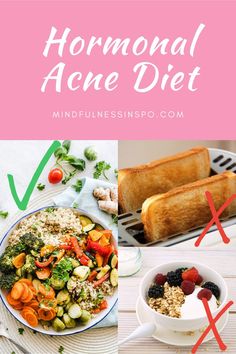 Clean Skin Diet, Foods To Clear Acne, Skin Care Routine Acne, Acne Skin Care Routine, Food For Acne, Back Acne Remedies