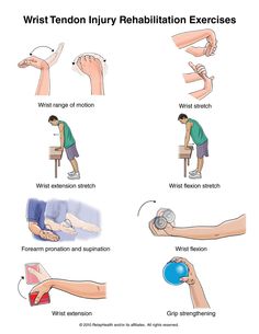 Tendinitis of wrist - Google Search