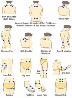 Tens Electrode Placement, Tens Unit Placement, Tens And Units, Tens Machine, Cupping Massage, Massage Therapy Techniques, Ten Unit, Kinesiology Taping