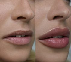 Lips Aesthetic, Lip Permanent Makeup, Permanente Make-up, Face Fillers, Lip Filler