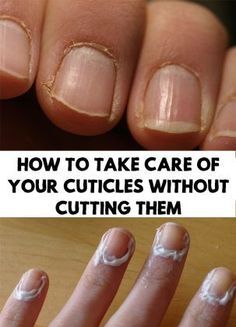 Skin Care Routine For Teens, Cuticle Care, Nail Cuticle, Pregnancy Health, Nail Health