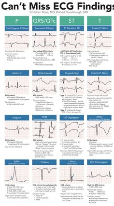 Cardiology Nursing, Paramedic School, Cardiac Nursing, Nursing School Survival, Critical Care Nursing, Nursing School Studying