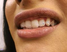 Tooth Gems Simple, Simple Tooth Gems, Teeth Jewels, Tooth Jewellery, Tooth Gem Ideas, Colored French Nails, Cinnamon Hair