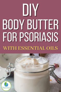 DIY Body Butter For Psoriasis and essential oils found useful Salve Recipes, Diy Body Butter, Body Butters Recipe, Lotion For Dry Skin, Best Essential Oils, Diy Body