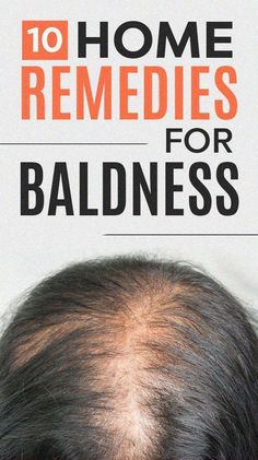 Hair Shedding Remedies, Natural Hair Remedies, Natural Hair Growth Remedies, Natural Hair Regrowth, Healthy Natural Hair Growth, Hair Regrowth Treatments, Hair Remedies For Growth, Home Remedies For Hair, New Hair Growth