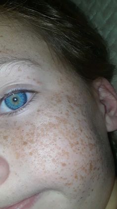 People With Blue Eyes, Beautiful Freckles, Bright Blue Eyes, Aqua Eyes, Natural Eye Makeup