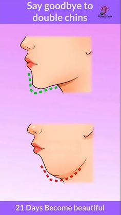 two different stages of chin surgery with the words say goodbye to double chins