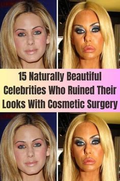 four different pictures of the same woman's face, with text that reads 15 naturally beautiful celebritys who ruined their looks with cosmetic surgery