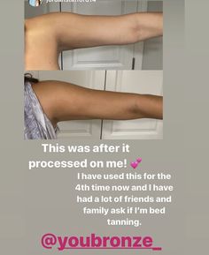 You Bronze Self Tanning Mousse before & after #selftanning #sunlesstanning #tanning #bronze #diy #skincare Diy Skincare, Skin