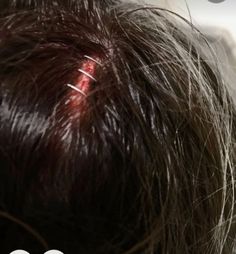 an image of someones hair with red spot on it