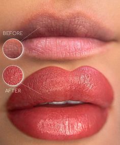 Coral Lips, Ingrown Hairs, Ombre Lips