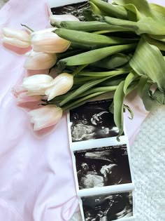 tulips are laid out on a pink blanket next to an x - ray