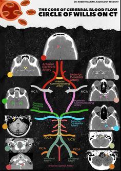 an mri scan shows the different areas of the brain and their corresponding functions in which they are