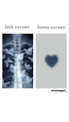 an x - ray shows the back and side of a heart, with text that reads lock screen home screen