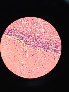 an image of some pink and purple cells