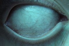 an eye is shown with the iris partially closed