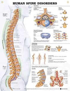 Spinal Misalignment, Spinal Column, Causes Of Back Pain, Human Spine, Spinal Nerve, Spine Health, Medical Anatomy, Spinal Cord, Anatomy And Physiology