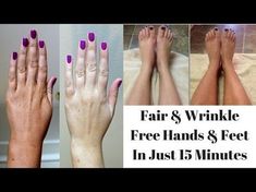 Wrinkle Free Hands, Softer Hands, Home Remedies For Wrinkles, Wrinkles Hands, Wrinkle Remedies