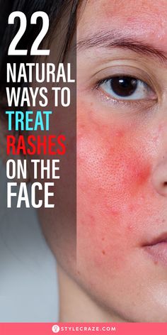 We all develop rashes from time to time. They are itchy, painful, distressing, and frustrating. While they go away on their own, sometimes they can be a symptom of an underlying medical condition.