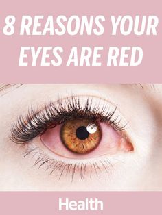 Red Veins In Eyes, Red Eyes Remedy, What Causes Red Eyes, Frankincense Oil Uses, Bloodshot Eyes, Calendula Benefits, Coconut Health Benefits, Red Patch