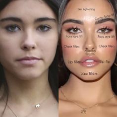 Madison Beer Plastic Surgery, Eyeliner Makeup Looks, Face Plastic Surgery, Rhinoplasty Nose Jobs, Botox Before And After