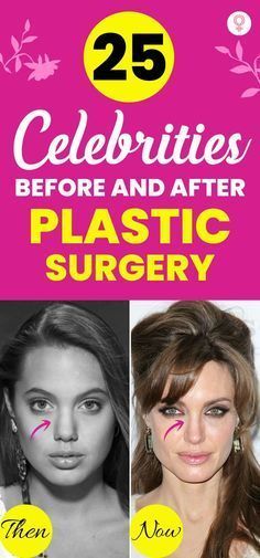 Celeb Plastic Surgery Before And After, Bad Celebrity Plastic Surgery Faces, Celebrity Before And After Surgery, Celebrities Before And After Surgery, Celebrity Plastic Surgery Before After, Celebrity Real Bodies, Sandra Bullock Plastic Surgery, Kris Jenner Plastic Surgery