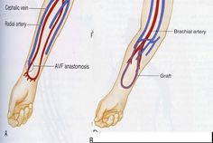 the blood vessels are labeled in red, white and blue with their corresponding vein lines