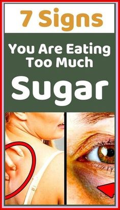 Just 7 Signs You Are Eating, Too Much Sugar! Vegan Probiotics, Turmeric Vitamins, Birthday Cakes For Her, Back Stretches For Pain, Healthy Morning Routine, Healthy Lifestyle Habits, Ate Too Much, Alternative Healing, Men's Health Fitness