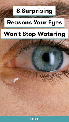 Excessively watery eyes have many potential causes, but they usually happen thanks to one of two mechanisms. Here are the causes and treatments for watery eyes that you need to know about. Watery Eyes Remedy, Blocked Tear Duct, Eyes Care, Eye Twitching, Eyes Watering, Tears In Eyes, Irritated Eye, Watery Eyes